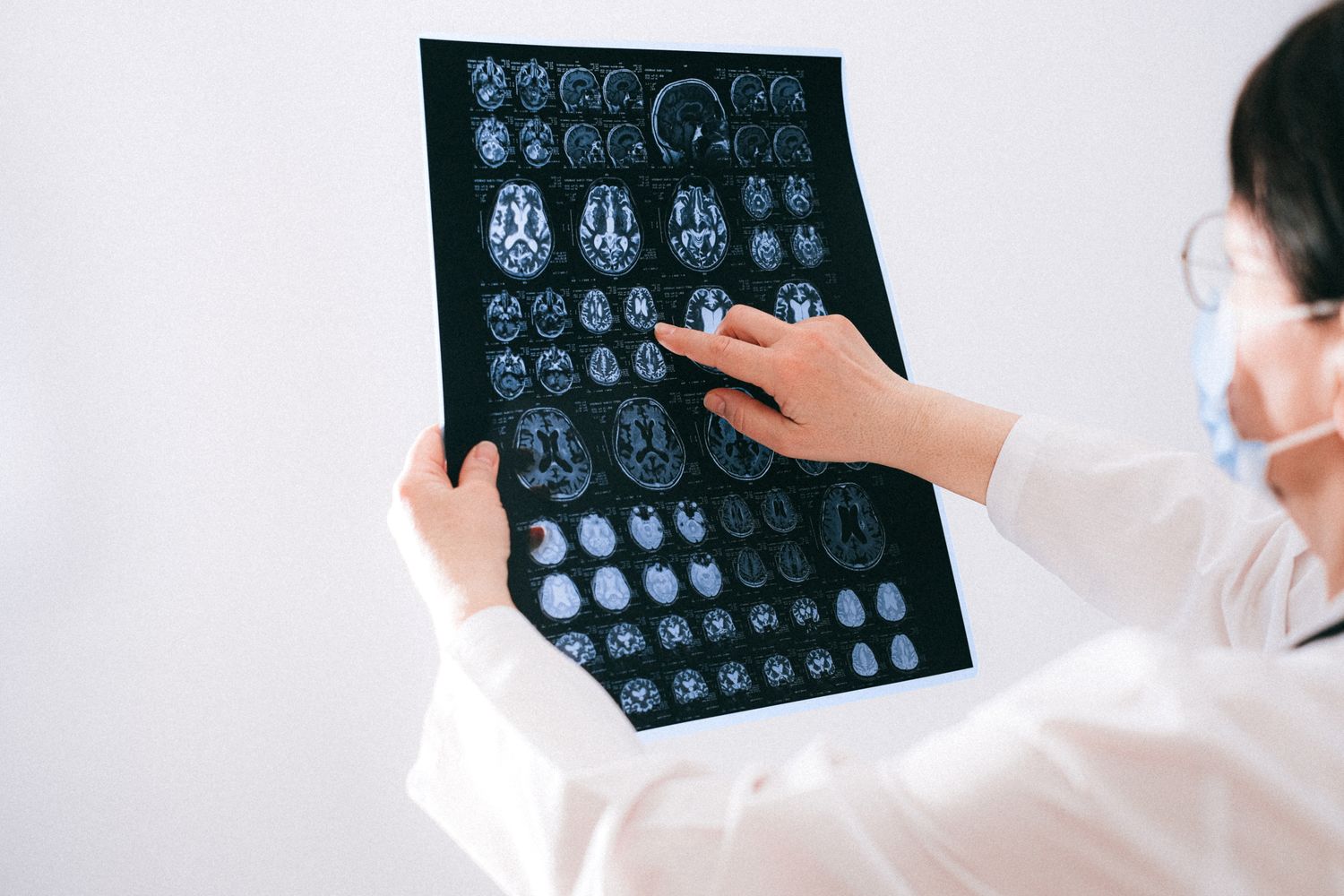 Neuro and Spine MRI Imaging